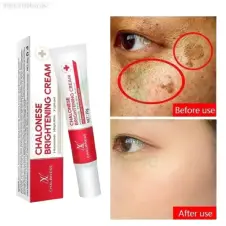 Chalonese Cream Price In Pakistan