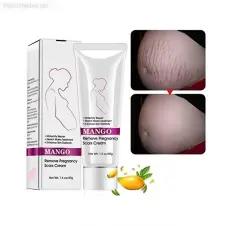 Rtopr Mango Stretch Mark Cream In Pakistan
